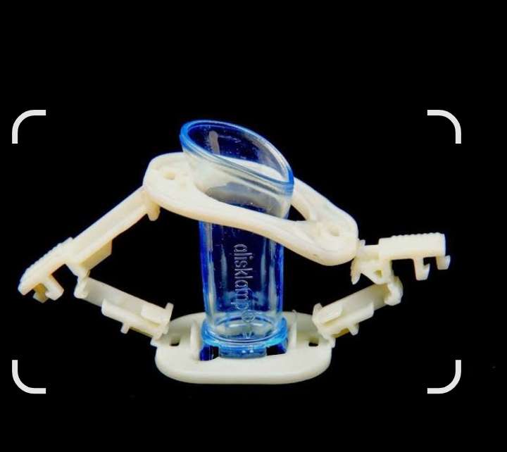 Alisklamp Circumcision Device